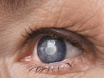 Detalhes da especialidade: Delaminação Corneana com Fotoablação Estromal